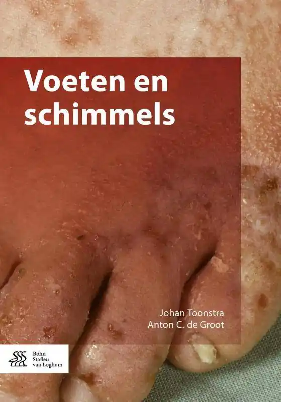 Gratis Retour Voeten en schimmels / Druk 1