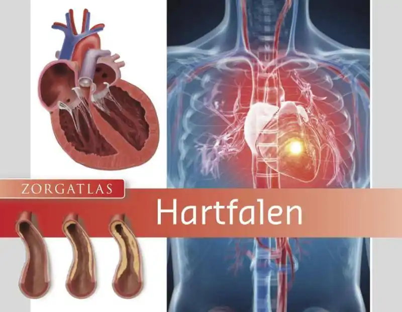 Meest Verkocht Hartfalen / Druk 1